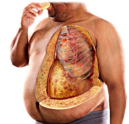 Kehon rasva - syy suorittaa KETO Complete-painonpudotuskurssi